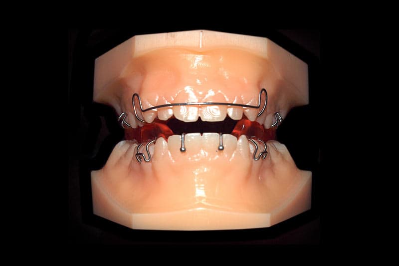 Dentacult_Orthodontic_Appliances_Cover